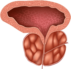Böyümüş prostat vəzi